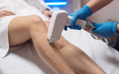 All You Need to Know About Laser Hair Removal